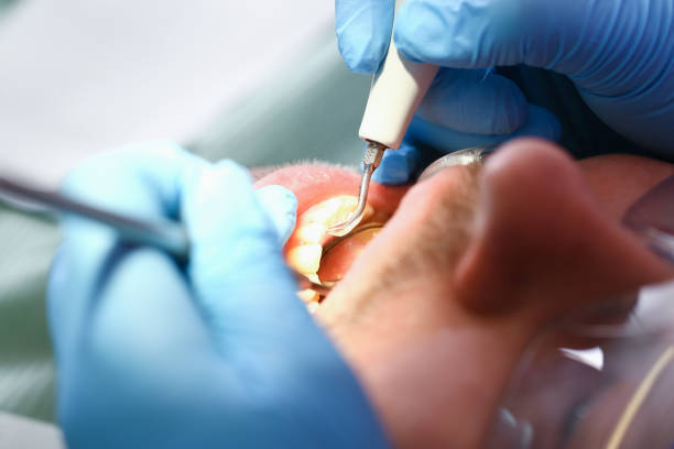 Best Emergency TMJ Treatment in Wilderness Rim, WA